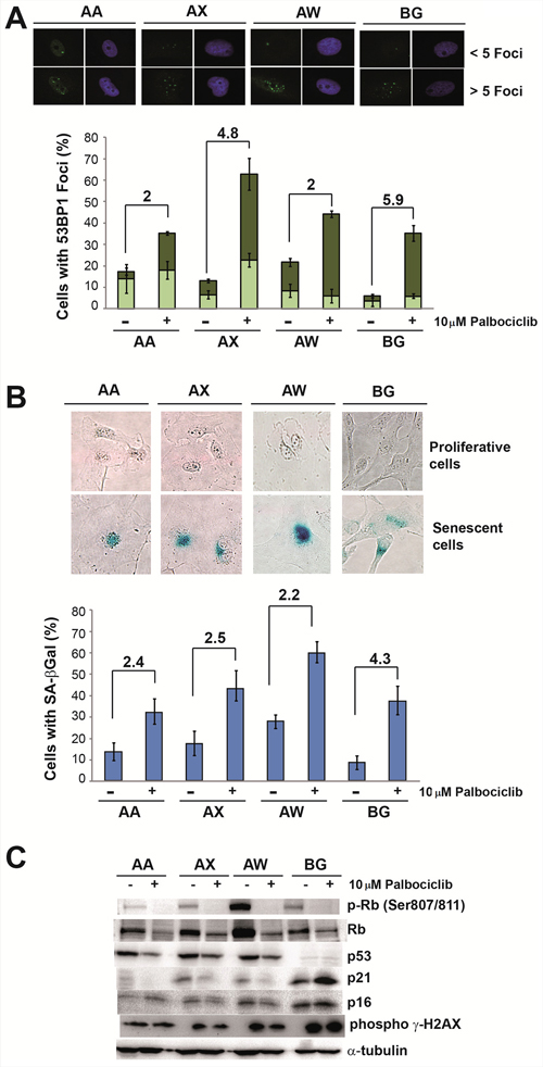 Palbociclib induces senescence markers in sarcoma cell lines.