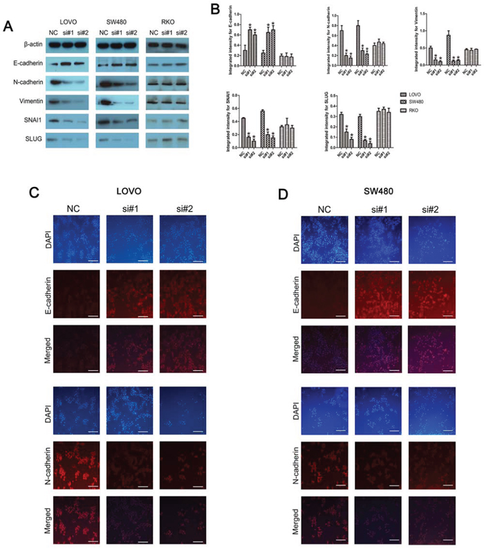 Knockdown of linc-POU3F3 inhibited EMT in CRC cells.