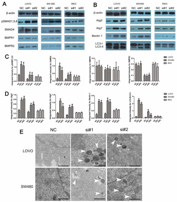 The involvement of BMP and autophagy pathway induced by linc-POU3F3 knockdown.