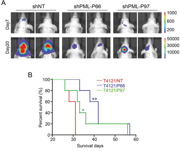 Disruption of PML in GSCs inhibits GSC-derived GBM tumor growth in vivo.