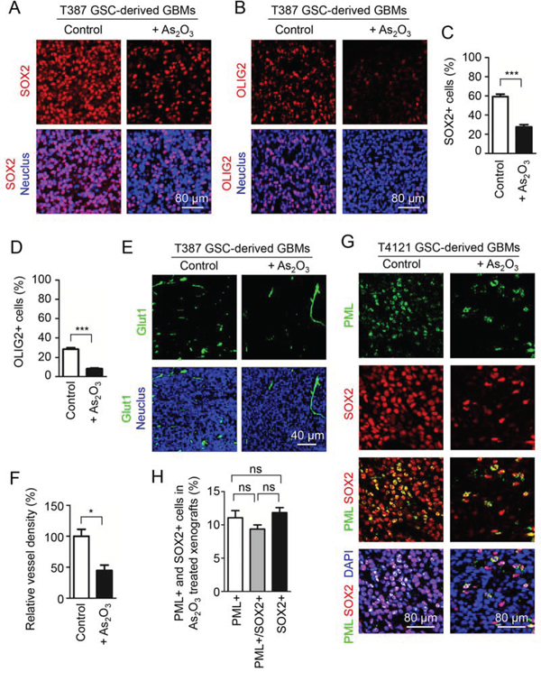 As2O3 treatment reduced PML protein and GSC population in vivo.