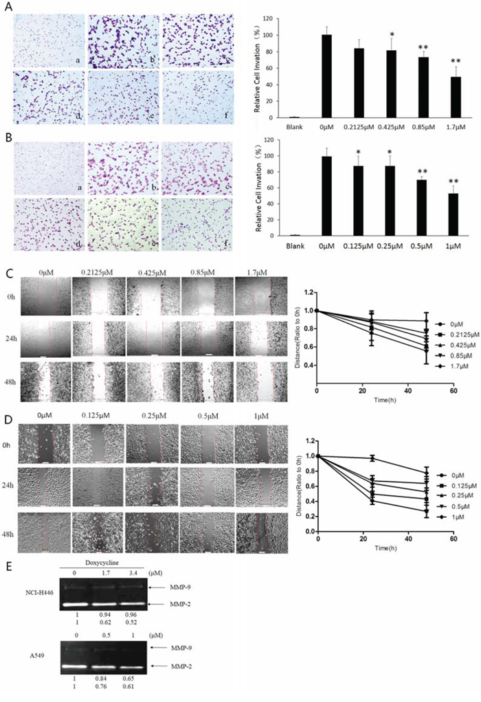 Effect of doxycycline on invasion, migration, and activities of matrix metalloproteinases (MMPs) of NCI-H446 and A549 cells.