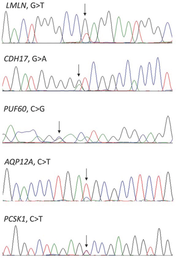 Confirmation by Sanger sequencing of the mutations detected by whole-exome sequencing.