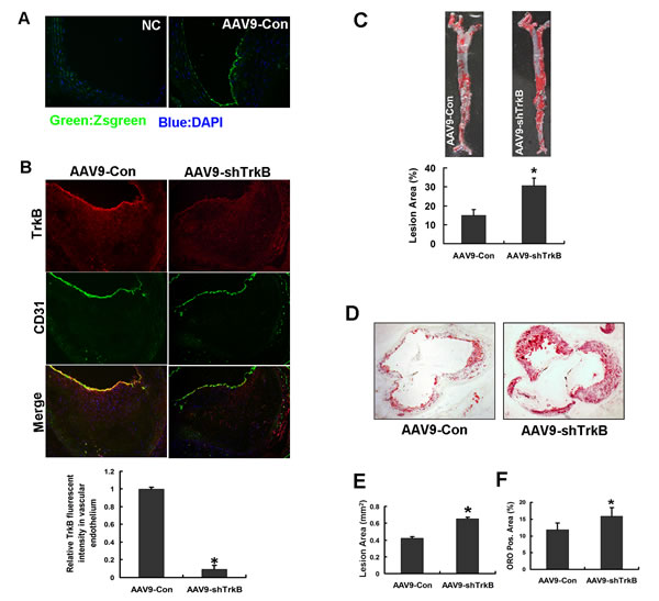 Endothelial TrkB confers atheroprotection in apoE-/- mice.