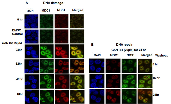 Localization and co-localization of MDC1 and NBS1 nuclear foci during DNA damage or during DNA repair following GLI1/GLI2 inhibition.