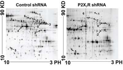 Proteomic analysis of the lymph nodes of P2X7R shRNA groups and control groups using 2-DE gels.