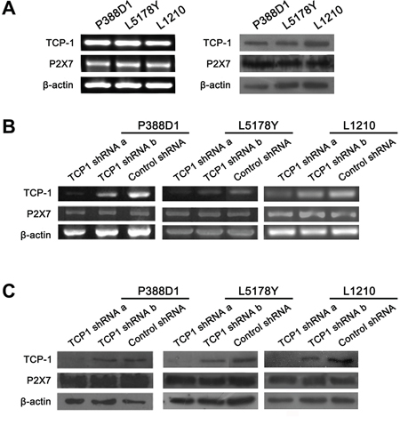 The expression of P2X7R and TCP-1 in different murine lymphoid neoplasm cell lines in TCP-1 shRNA group, control shRNA group and control group in vitro.