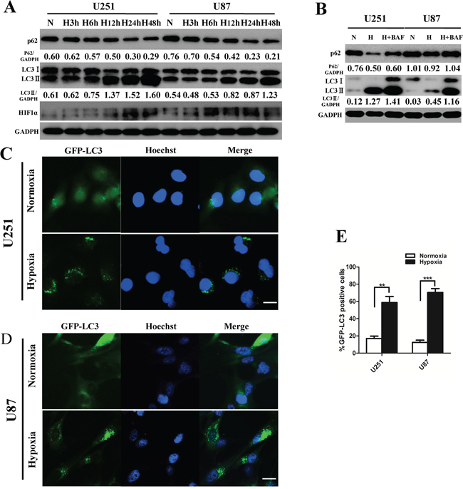 Hypoxia induces glioblastoma cell autophagic activity.