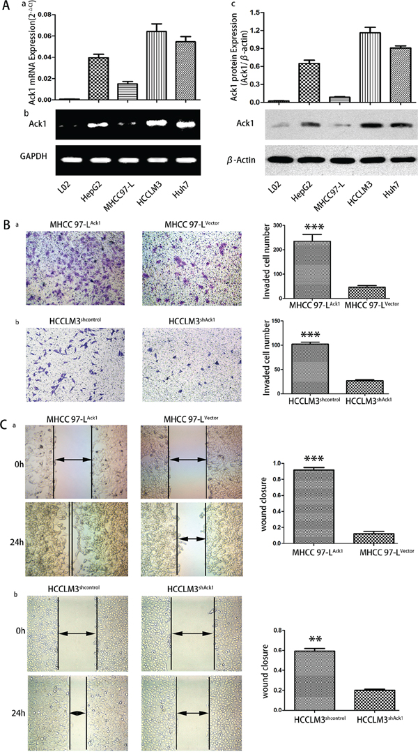 Ack1 promotes HCC cells invasion in vitro.