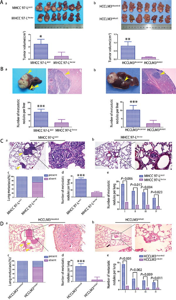 Ack1 promotes HCC cells metastasis in vivo.