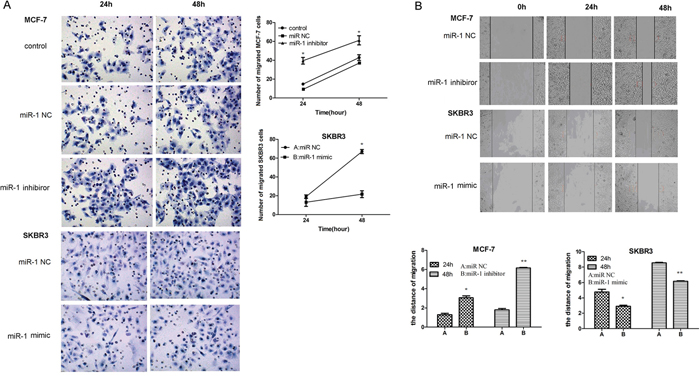 miR-1 inhibits the migration and wound healing of CSC in vitro.