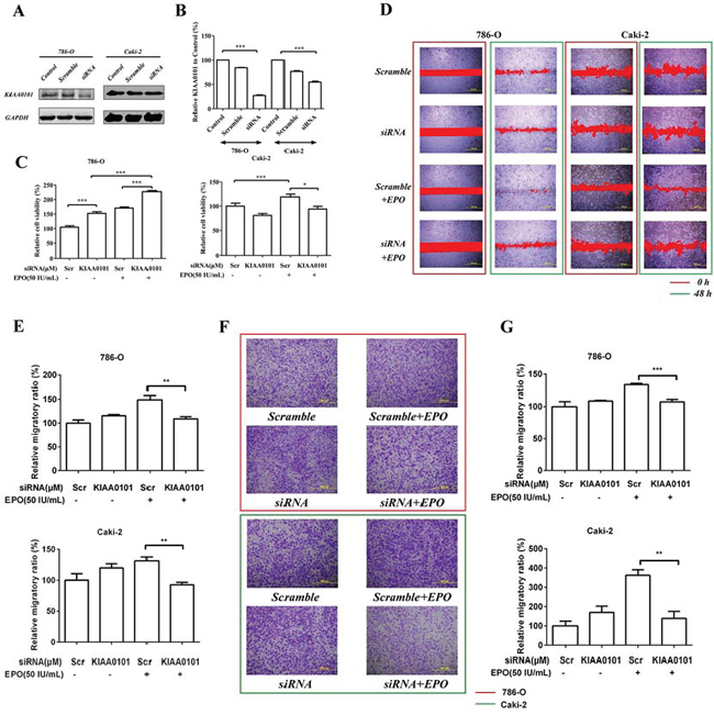 Cell proliferation and migration induced by r-Hu EPO before and after KIAA0101 knockdown.