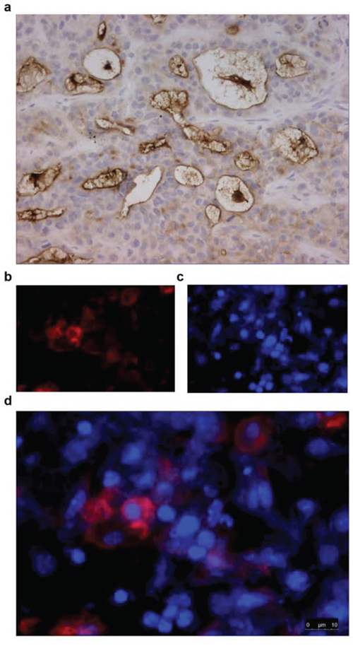 Immunohistochemical staining for mesothelin of HPAC tumor material from mice injected with 100 &#x03BC;g AMA-800CW (tumor harvested 144 h after injection).