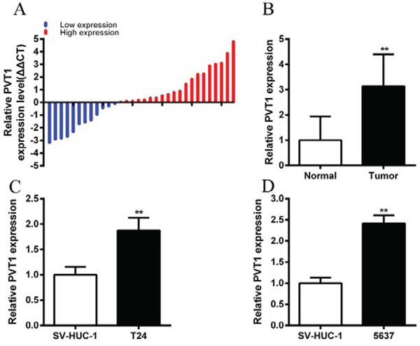 PVT1 was upregulated in bladder cancer tissues and cell lines.