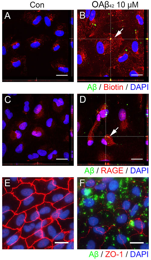 Extracellular A&#x3b2; translocates into intracellular space via RAGE-mediated endocytosis in RPE.