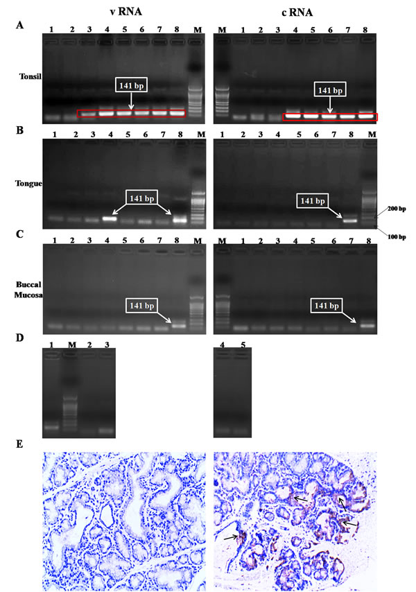 Detection of viral replication in the oral cavity after oral immunization by nested RT-PCR and IHC.