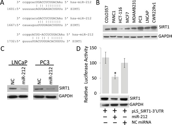 miR-212 inhibits the expression of SIRT1 in prostate cancer Cells.