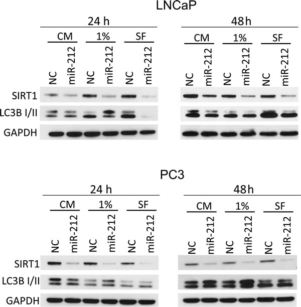 miR-212 inhibits autophagy induced by serum starvation.