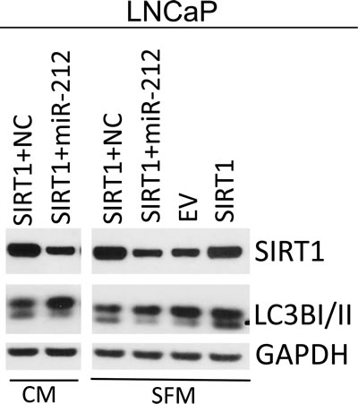 miR-212 inhibits SIRT1 induced autophagy.
