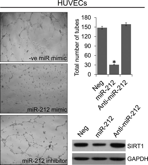 miR-212 inhibits angiogenesis.