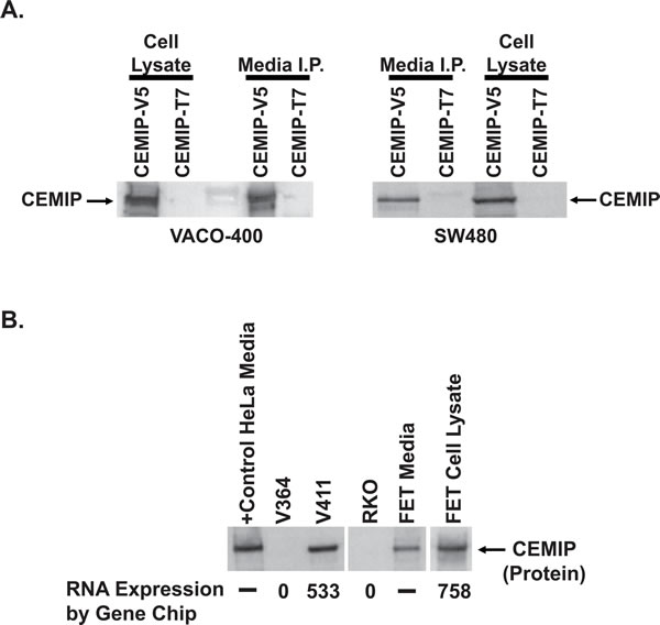 Secretion of CEMIP protein.