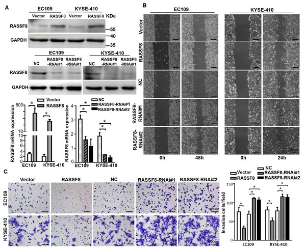 RASSF8 is essential for ESCC cell motility and invasiveness.