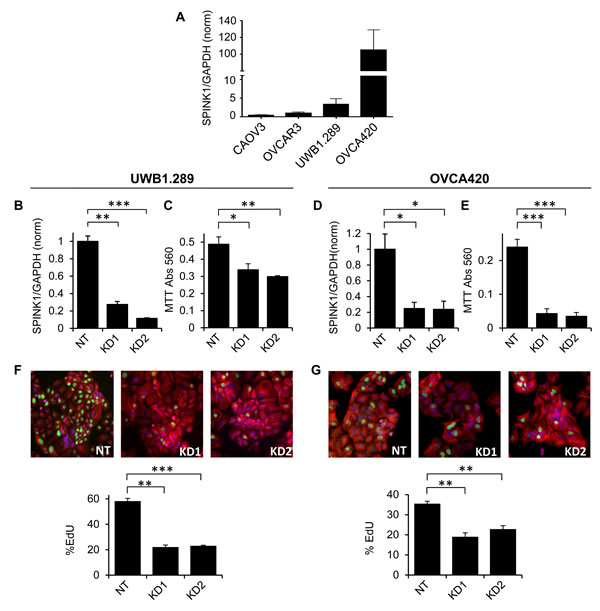 Endogenous SPINK1 expression drives proliferation of ovarian cancer cells.
