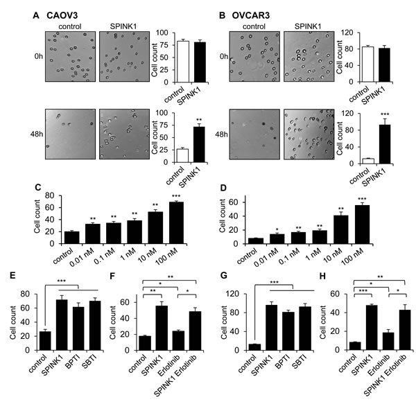 SPINK1 promotes resistance to anoikis in ovarian cancer cells.
