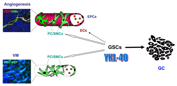 A model for YKL-40-mediated tumor vascularization that is associated with vascular transdifferentiation of GSCs in GBM.