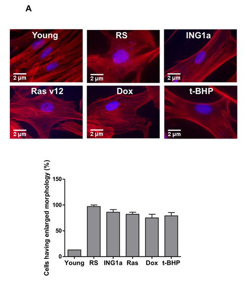 Comparison of senescence markers induced by SIPS