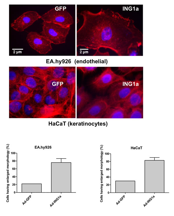 ING1a induces changes to the actin cytoskeleton in primary endothelial cells (top panel) and keratinocytes (bottom panel).