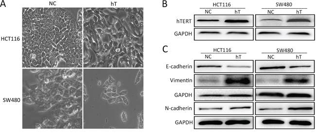 hTERT promotes EMT in colorectal cancer cell lines.