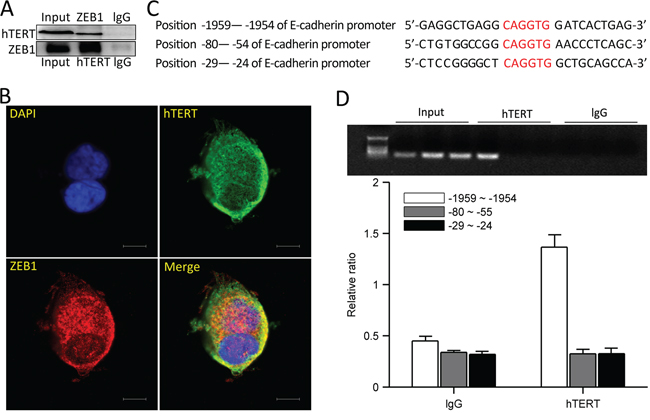 hTERT and ZEB1 form a complex and bind the E-cadherin promoter.
