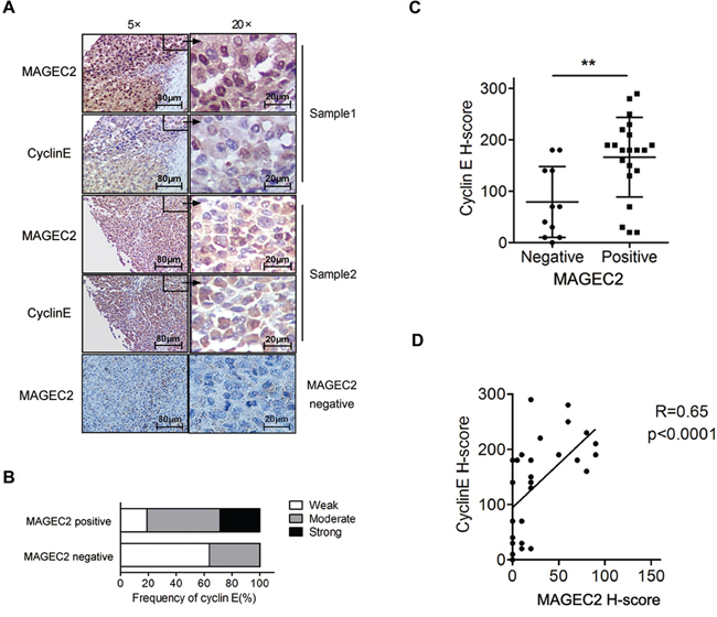 Expression levels of cyclin E correlate with MAGE-C2 expression in malignant melanoma tissues.