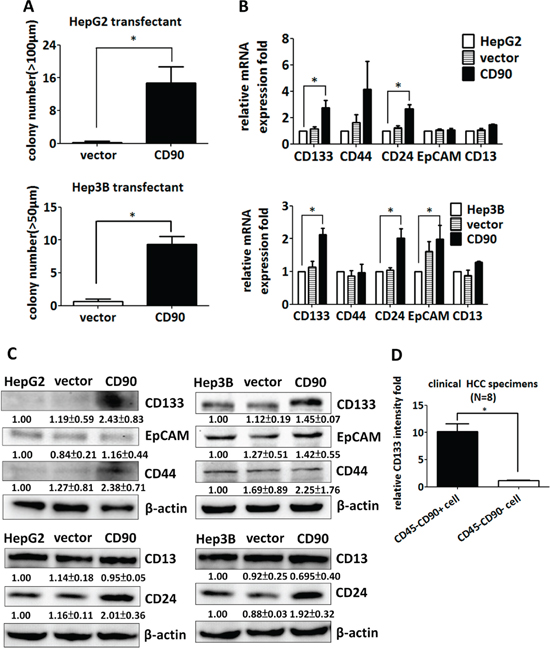 CD90 increases sphere formation and the expression of cancer stem cell markers in cell lines and tumor specimens.
