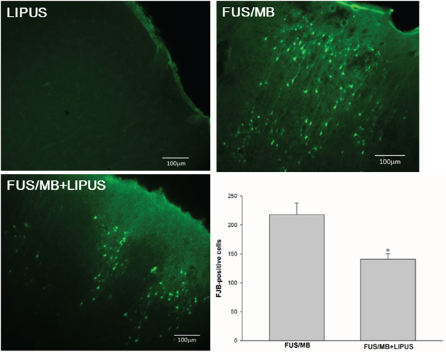 Effects of LIPUS treatment on neuronal degeneration.