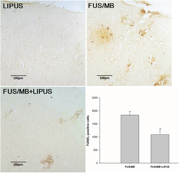 Effects of LIPUS treatment on apoptotic cell death in the sonicated brain.