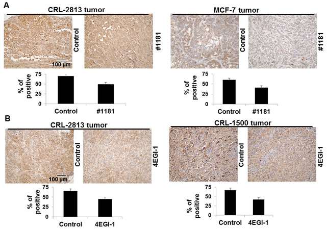 #1181 and 4EGI-1 down-regulate the phosphorylation of 4E-BP1 in tumors.