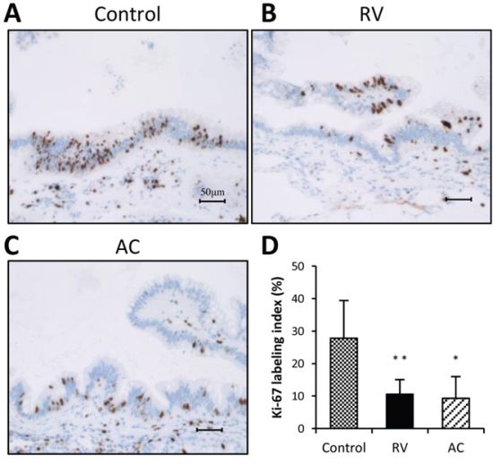 Ki-67 immunohistochemistry and labeling indices of pancreatic dysplasia in BOP-treated hamsters.