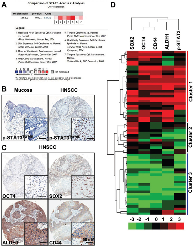 STAT3 signaling is activated in head and neck cancer.