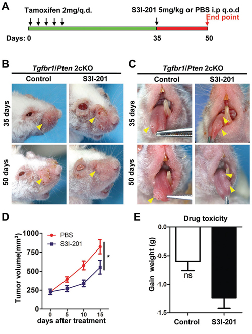 Chemotherapeutic treatment of S3I-201 in Tgfbr1/Pten 2cKO mice HNSCC.