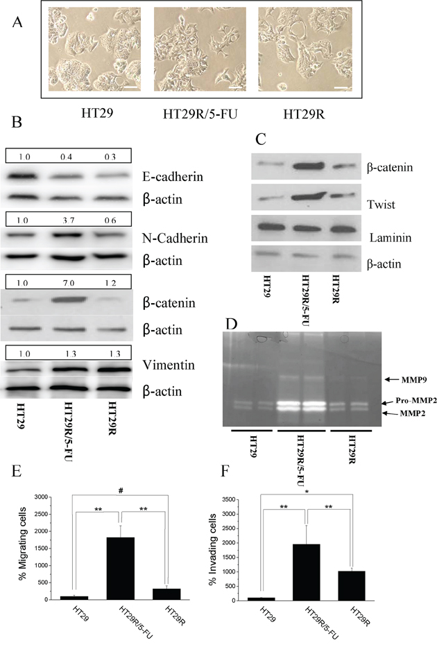 Chronic treatment with 20 &#x03BC;M 5-FU stimulates EMT in HT29R cells.