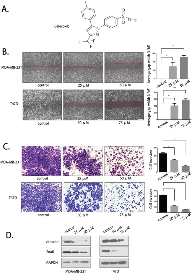 Selective COX-2 inhibition by celecoxib suppressed breast cancer cell migration and invasion.