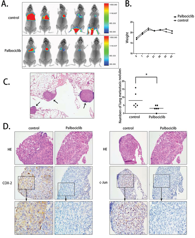 The anti-metastasis activity of palbociclib in vivo.