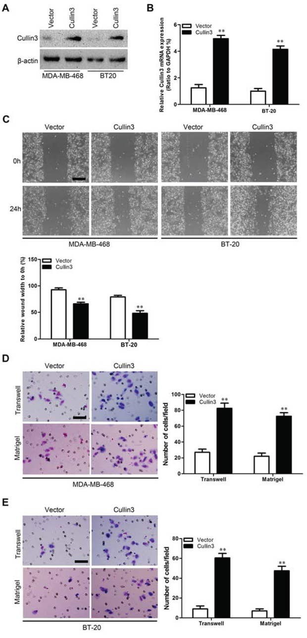 Ectopic expression Cullin3 promotes migratory and invasive capacities of BC cells in vitro.