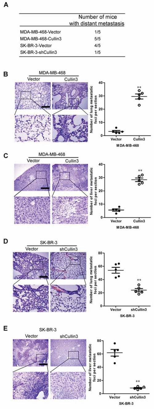 CUL4A promotes metastasis of human breast cancer cells.