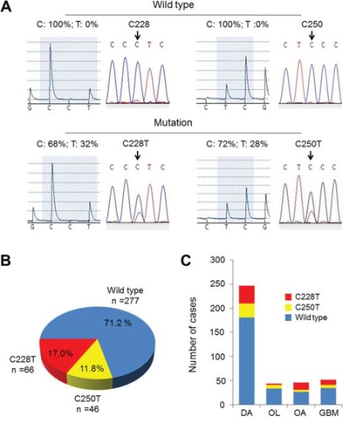 TERT promoter mutations in gliomas.