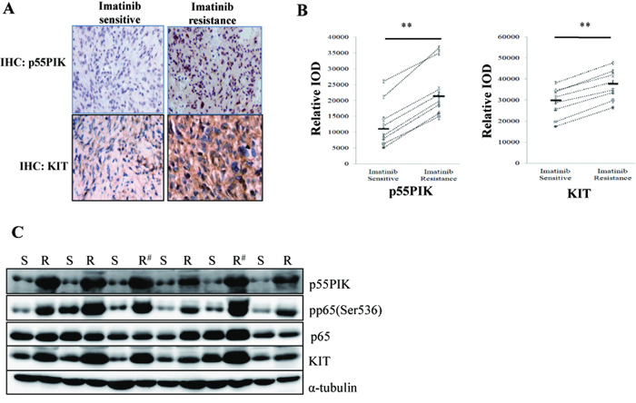 Over-expression of KIT and p55PIK and NF-&#x03BA;B activation in tumor samples from IMA-resistance-GIST patients.