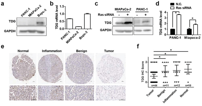 TDG is downregulated in pancreatic cancer.