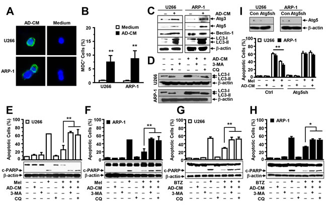 Addition of adipocyte- conditioned media (CM) activates autophagy in MM cells.